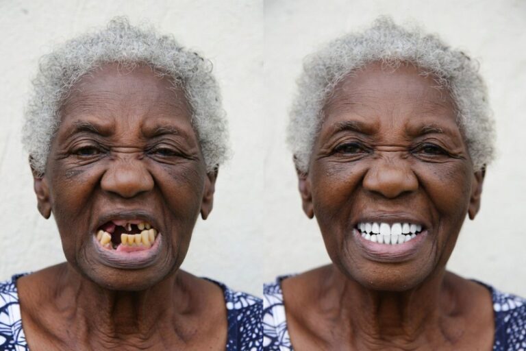 Quanto Tempo Demora Para Conseguir Tratamento Dentário Pelo SUS?